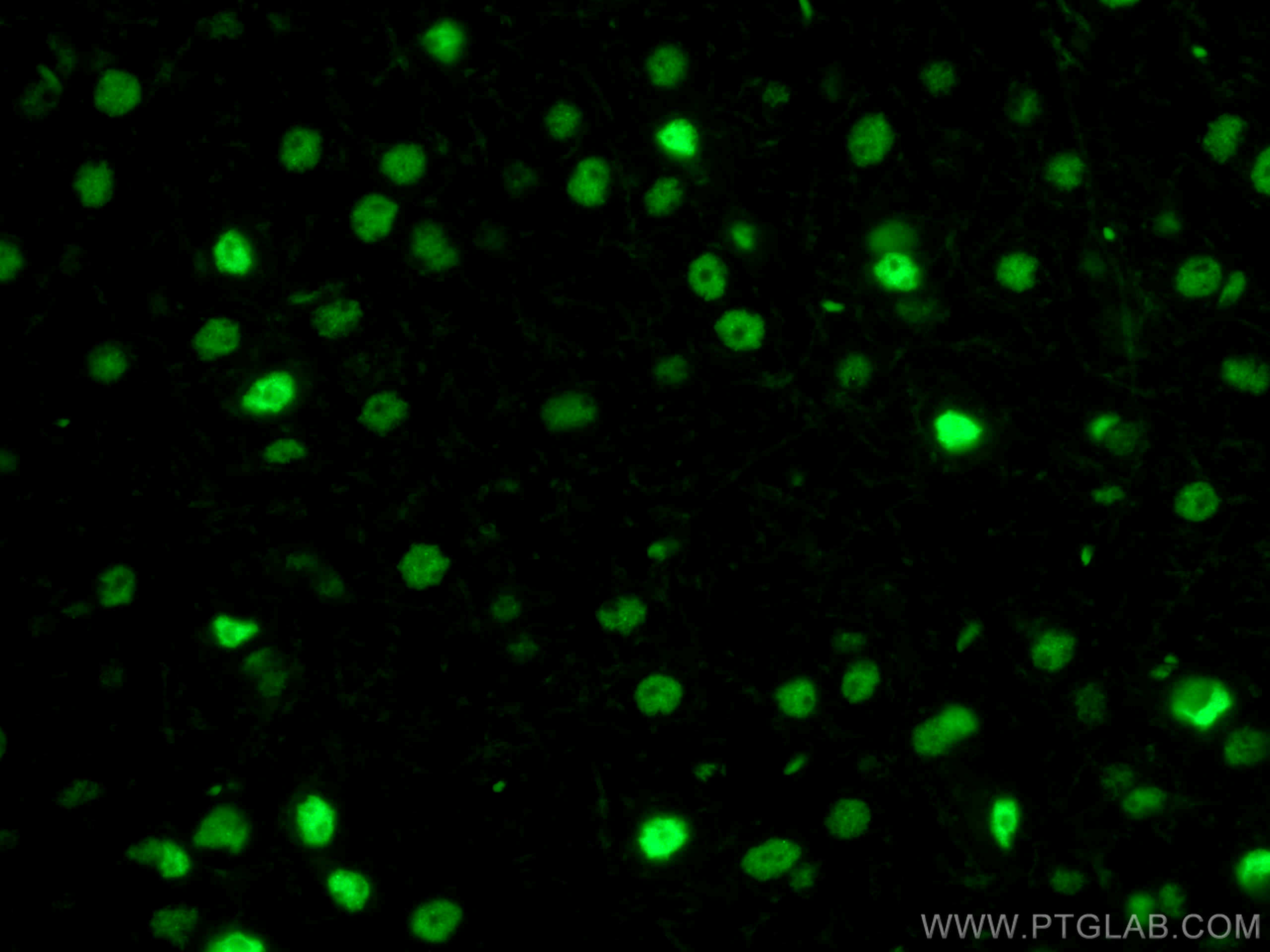 Immunofluorescence (IF) / fluorescent staining of mouse brain tissue using CoraLite® Plus 488-conjugated TDP-43 (for IF/FC) R (CL488-80002)