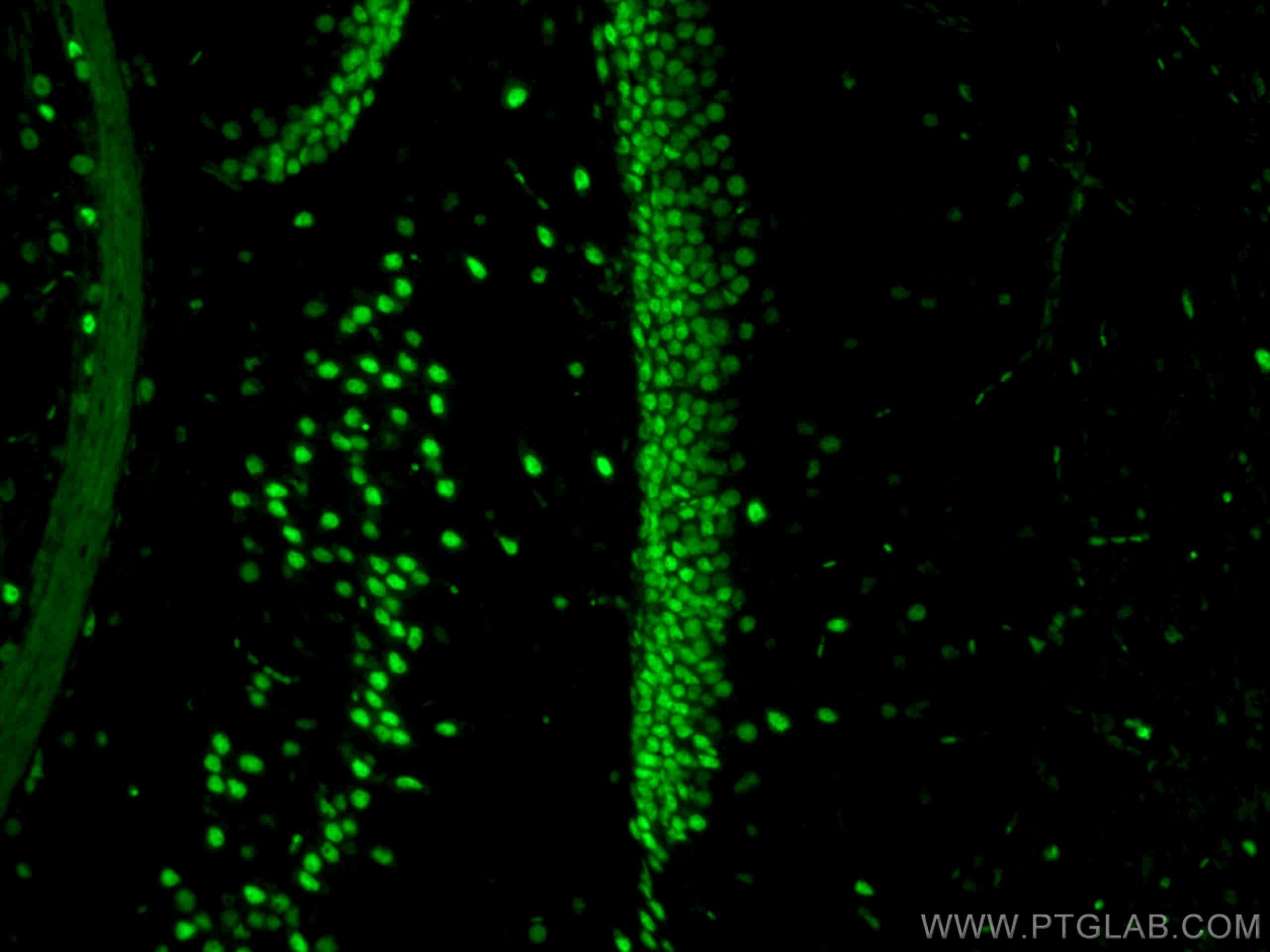 Immunofluorescence (IF) / fluorescent staining of mouse brain tissue using CoraLite® Plus 488-conjugated TDP-43 (for IF/FC) R (CL488-80002)