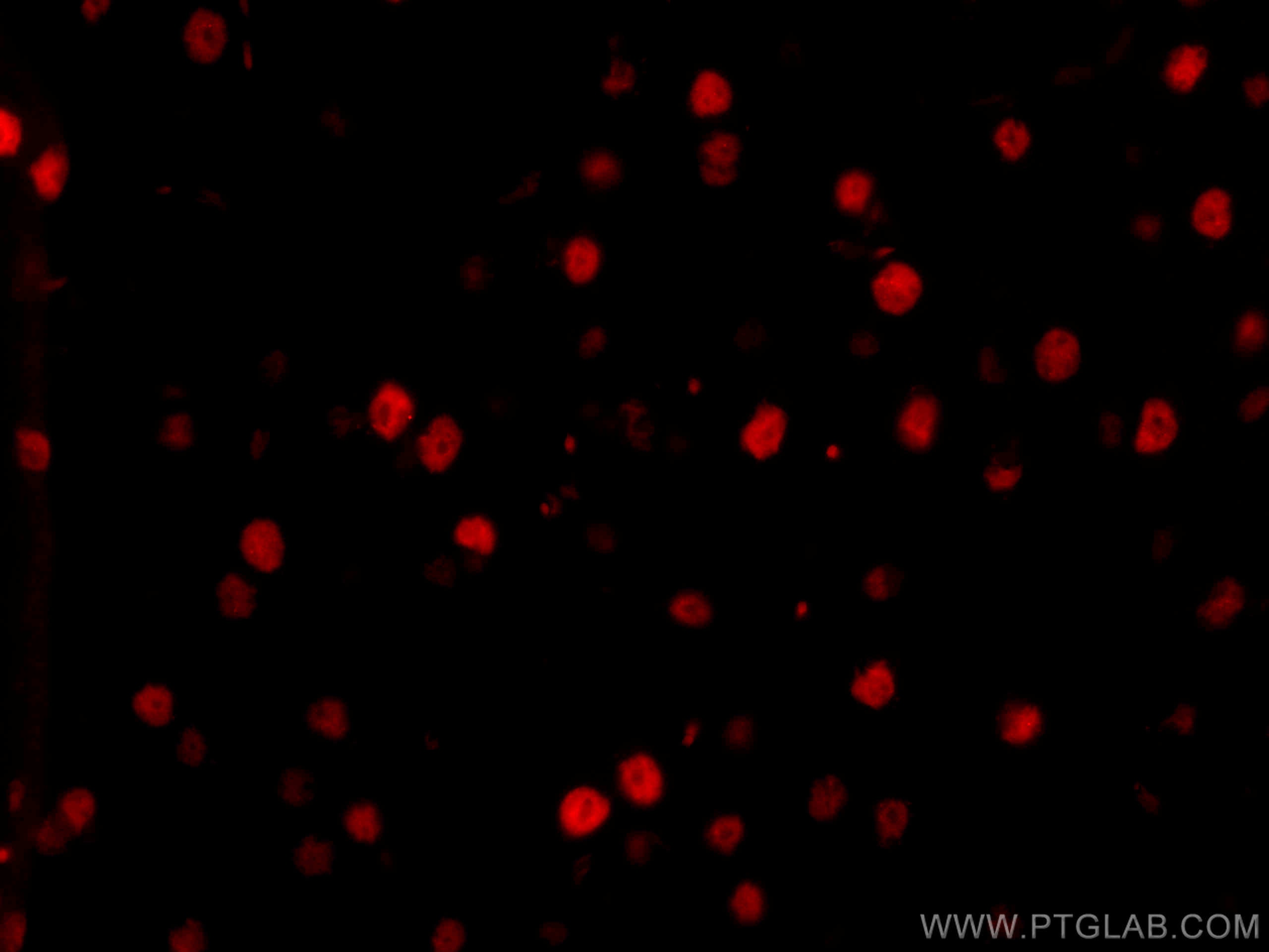 Immunofluorescence (IF) / fluorescent staining of mouse brain tissue using CoraLite®594-conjugated TDP-43 (for IF/FC) Recombi (CL594-80002)