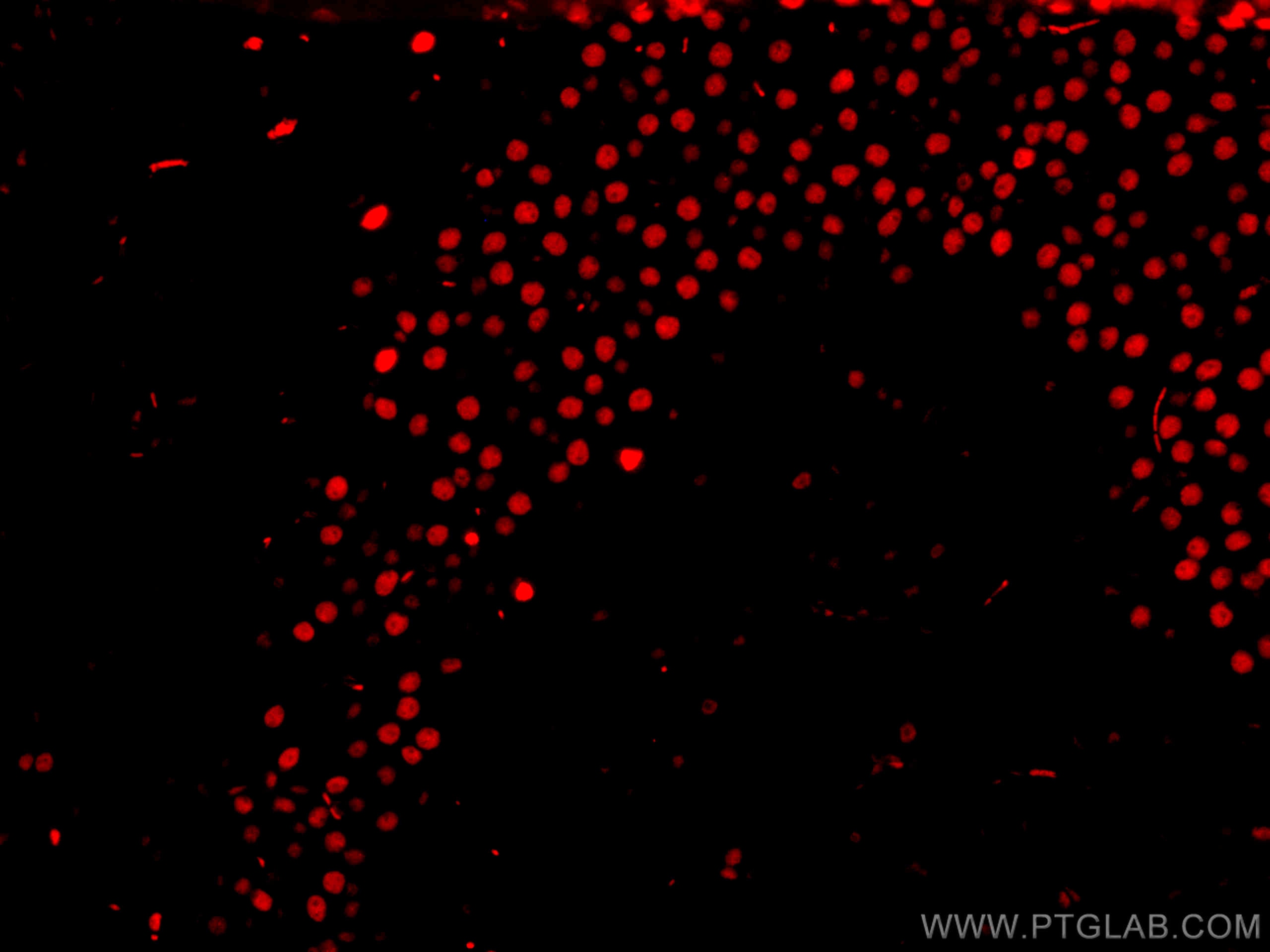 Immunofluorescence (IF) / fluorescent staining of mouse brain tissue using CoraLite®594-conjugated TDP-43 (for IF/FC) Recombi (CL594-80002)