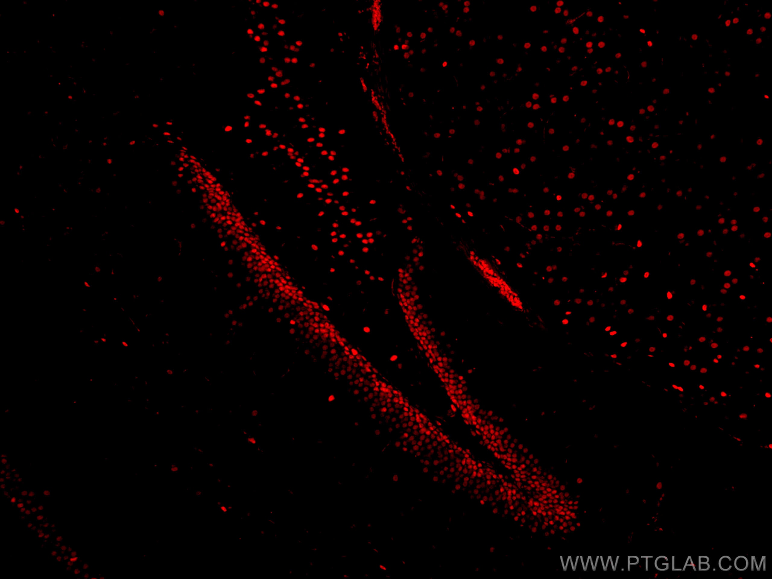 Immunofluorescence (IF) / fluorescent staining of mouse brain tissue using CoraLite®594-conjugated TDP-43 (for IF/FC) Recombi (CL594-80002)