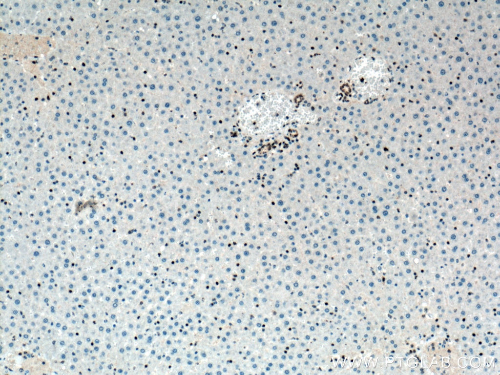 Immunohistochemistry (IHC) staining of rat liver tissue using TDP-43 Monoclonal antibody (66734-1-Ig)