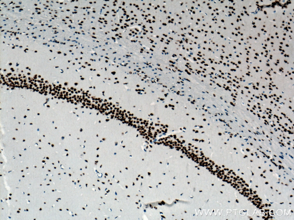 Immunohistochemistry (IHC) staining of mouse brain tissue using TDP-43 Monoclonal antibody (66734-1-Ig)