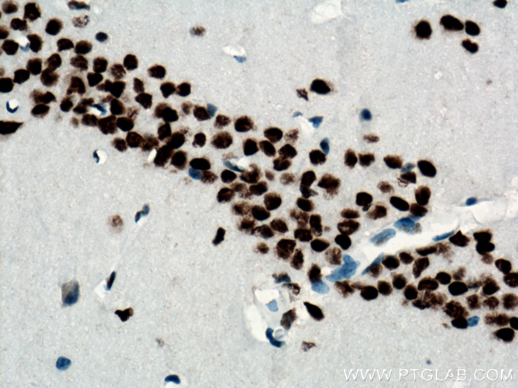 Immunohistochemistry (IHC) staining of mouse brain tissue using TDP-43 Monoclonal antibody (66734-1-Ig)