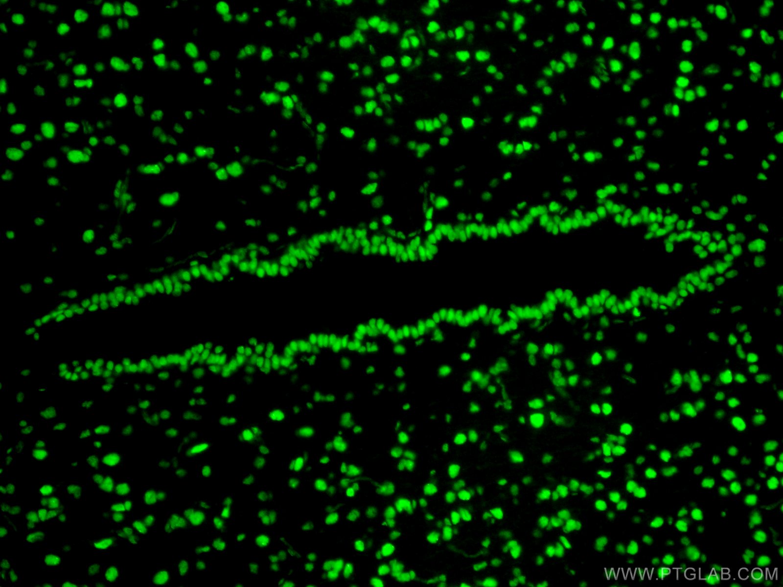 IF Staining of rat brain using 80001-1-RR