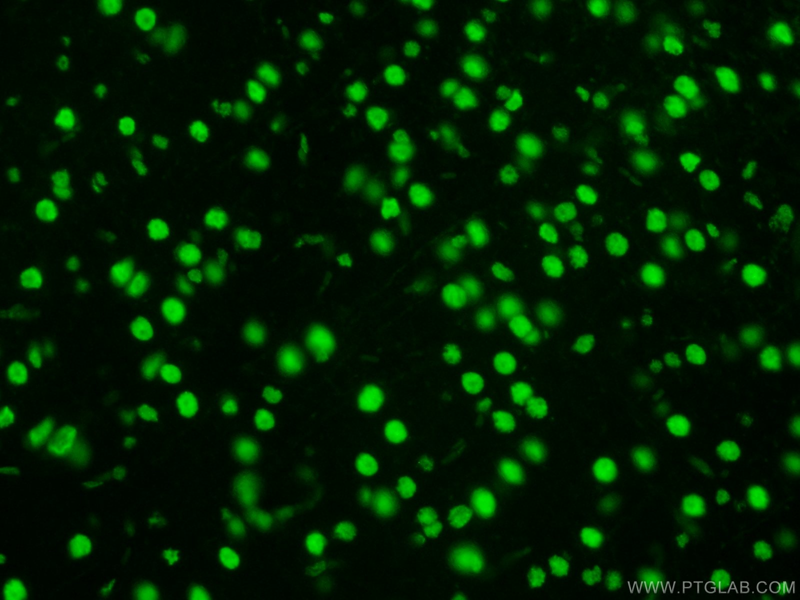 Immunofluorescence (IF) / fluorescent staining of rat brain tissue using TDP-43 Recombinant antibody (80001-1-RR)