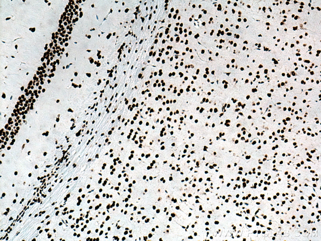 Immunohistochemistry (IHC) staining of mouse brain tissue using TDP-43 Recombinant antibody (80001-1-RR)