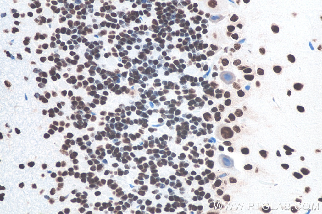 IHC staining of rat cerebellum using 80001-1-RR Immunohistochemistry (IHC) staining of rat cerebellum tissue using TDP-43 (N-terminal) Recombinant monoclonal antibod (80001-1-RR)