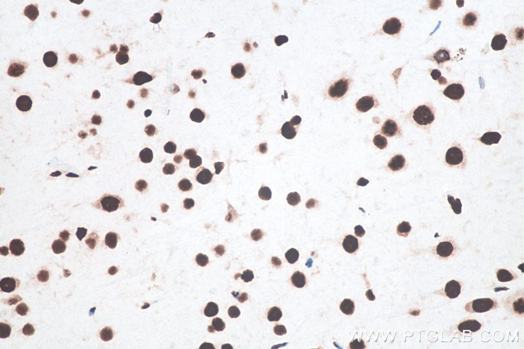 IHC staining of rat brain using 80001-1-RR Immunohistochemistry (IHC) staining of rat brain tissue using TDP-43 (N-terminal) Recombinant monoclonal antibod (80001-1-RR)