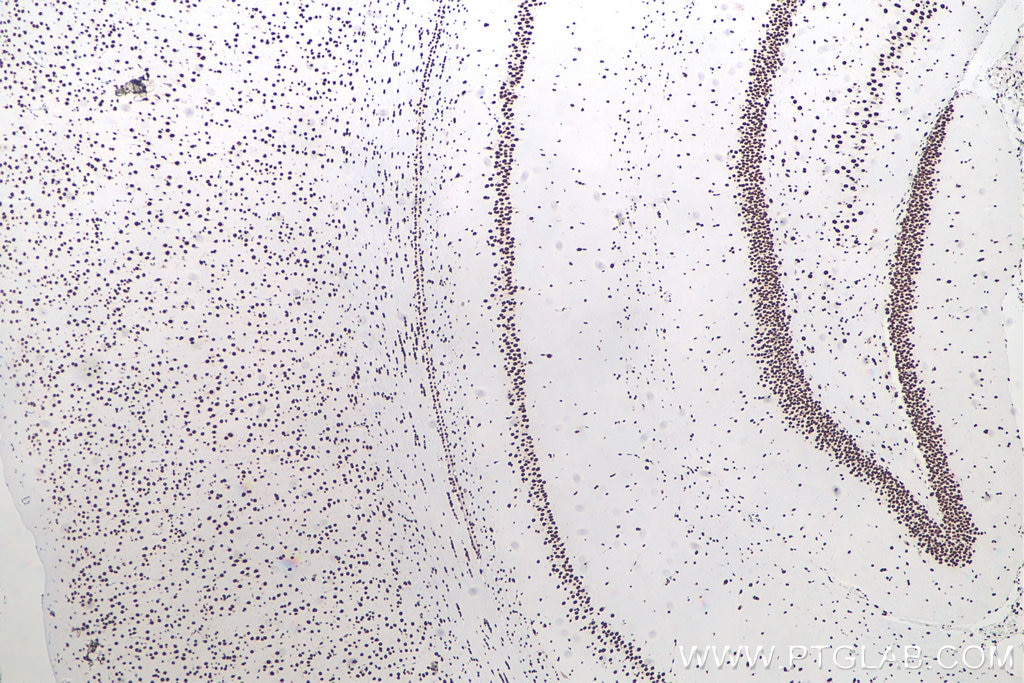 IHC staining of rat brain using 80001-1-RR Immunohistochemistry (IHC) staining of rat brain tissue using TDP-43 (N-terminal) Recombinant monoclonal antibod (80001-1-RR)