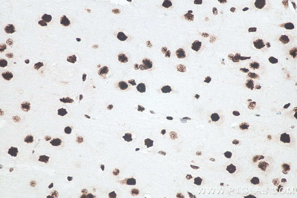 IHC staining of human brain using 80001-1-RR Immunohistochemistry (IHC) staining of human brain tissue using TDP-43 (N-terminal) Recombinant monoclonal antibod (80001-1-RR)