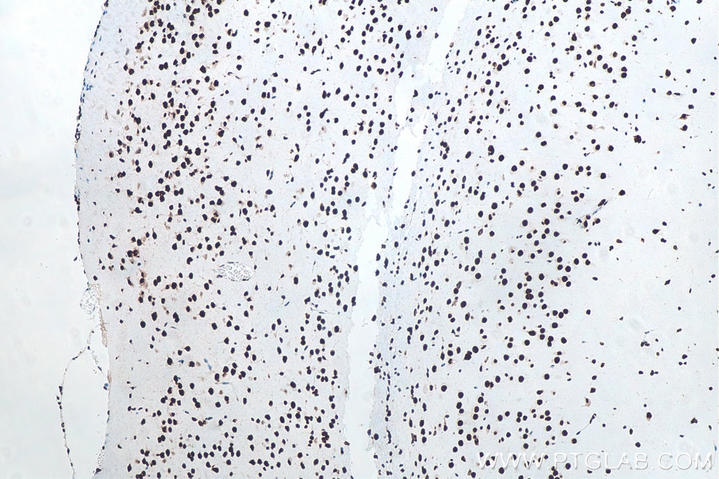 IHC staining of mouse brain using 80001-1-RR Immunohistochemistry (IHC) staining of mouse brain tissue using TDP-43 (N-terminal) Recombinant monoclonal antibod (80001-1-RR)