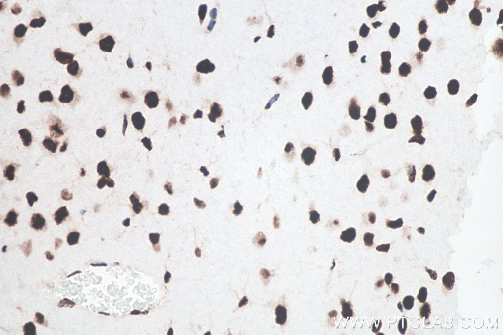 IHC staining of mouse brain using 80001-1-RR Immunohistochemistry (IHC) staining of mouse brain tissue using TDP-43 (N-terminal) Recombinant monoclonal antibod (80001-1-RR)