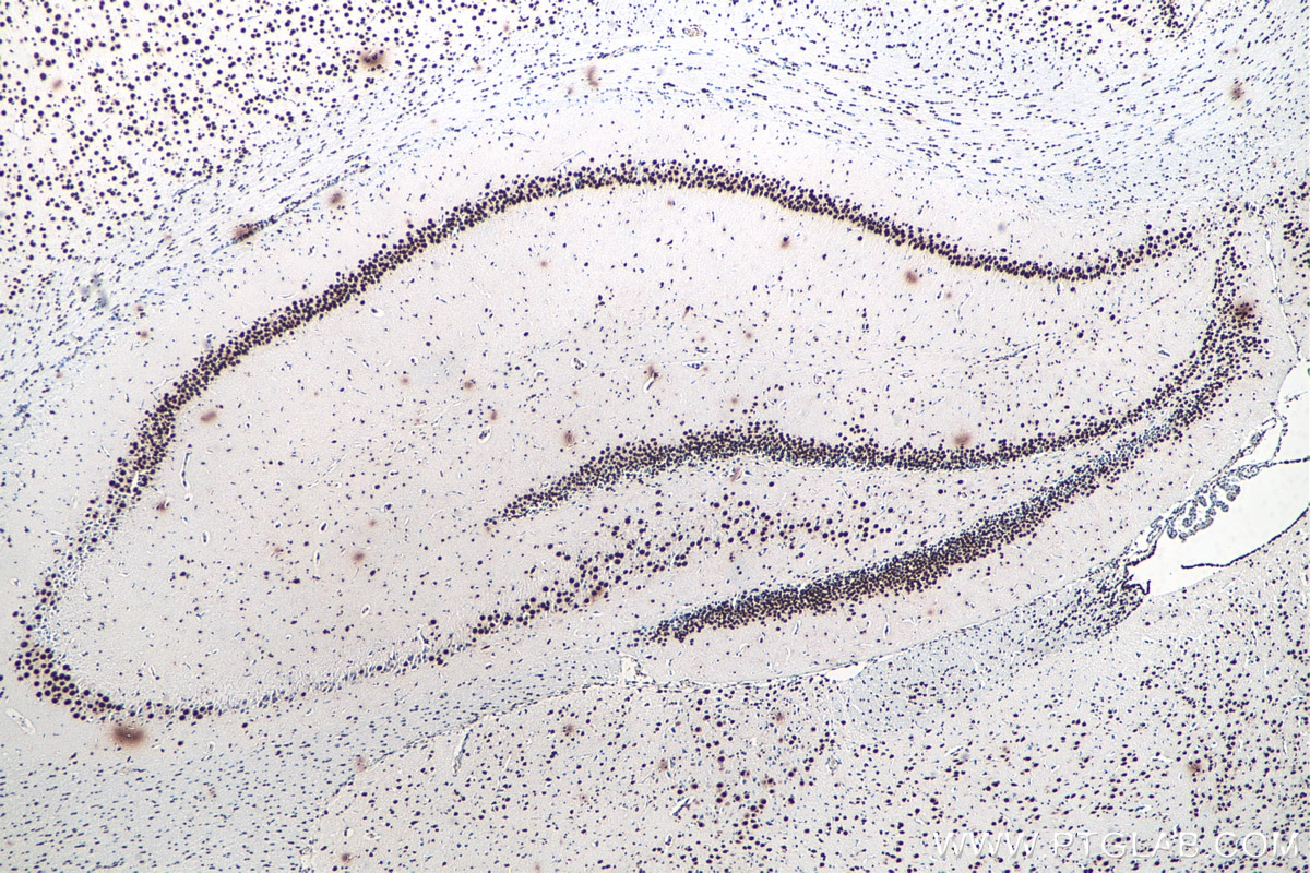 Immunohistochemistry (IHC) staining of rat brain tissue using TDP-43 Recombinant antibody (80001-1-RR)