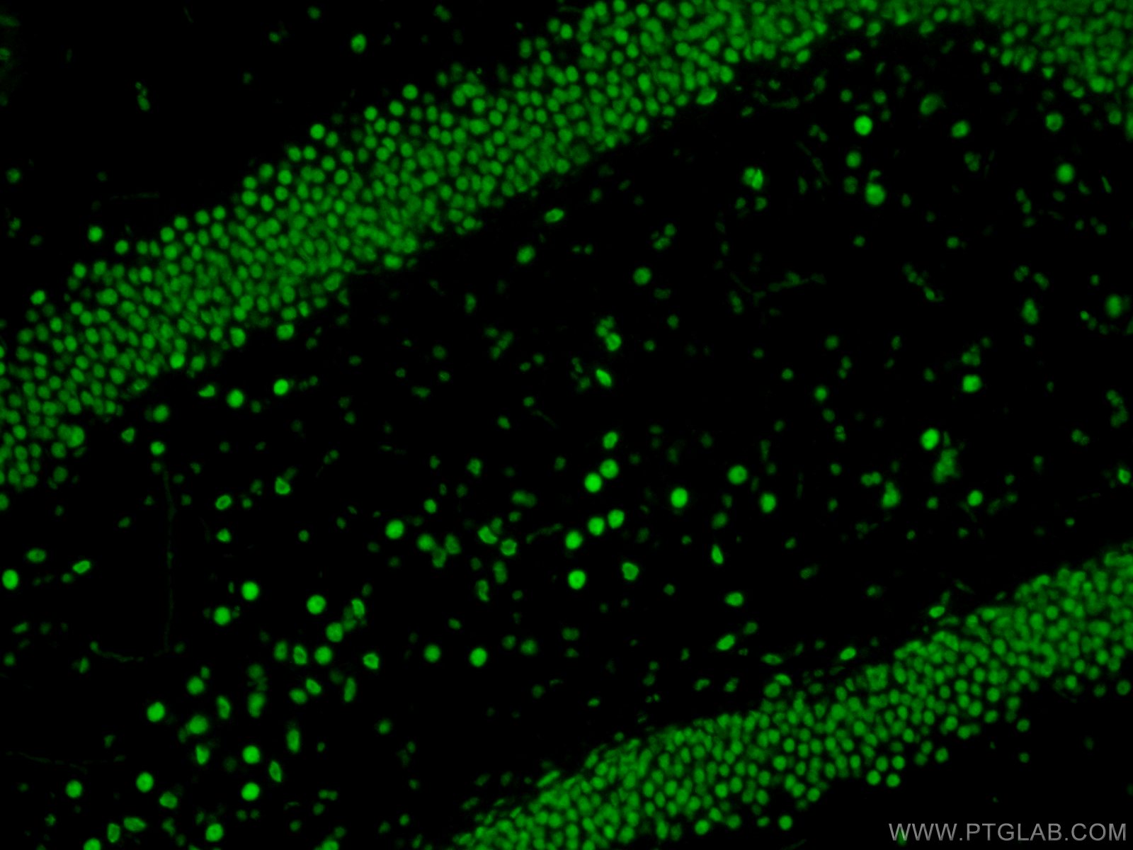 Immunofluorescence (IF) / fluorescent staining of rat brain tissue using TDP-43 Recombinant antibody (80002-1-RR)