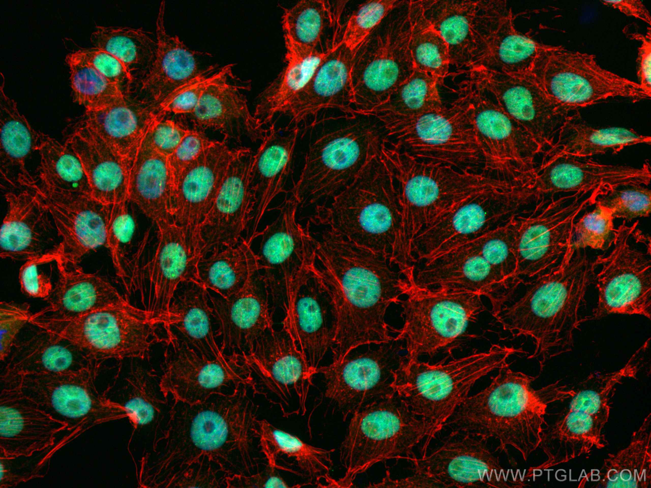 Immunofluorescence (IF) / fluorescent staining of SH-SY5Y cells using TDP-43 Recombinant antibody (80002-1-RR)