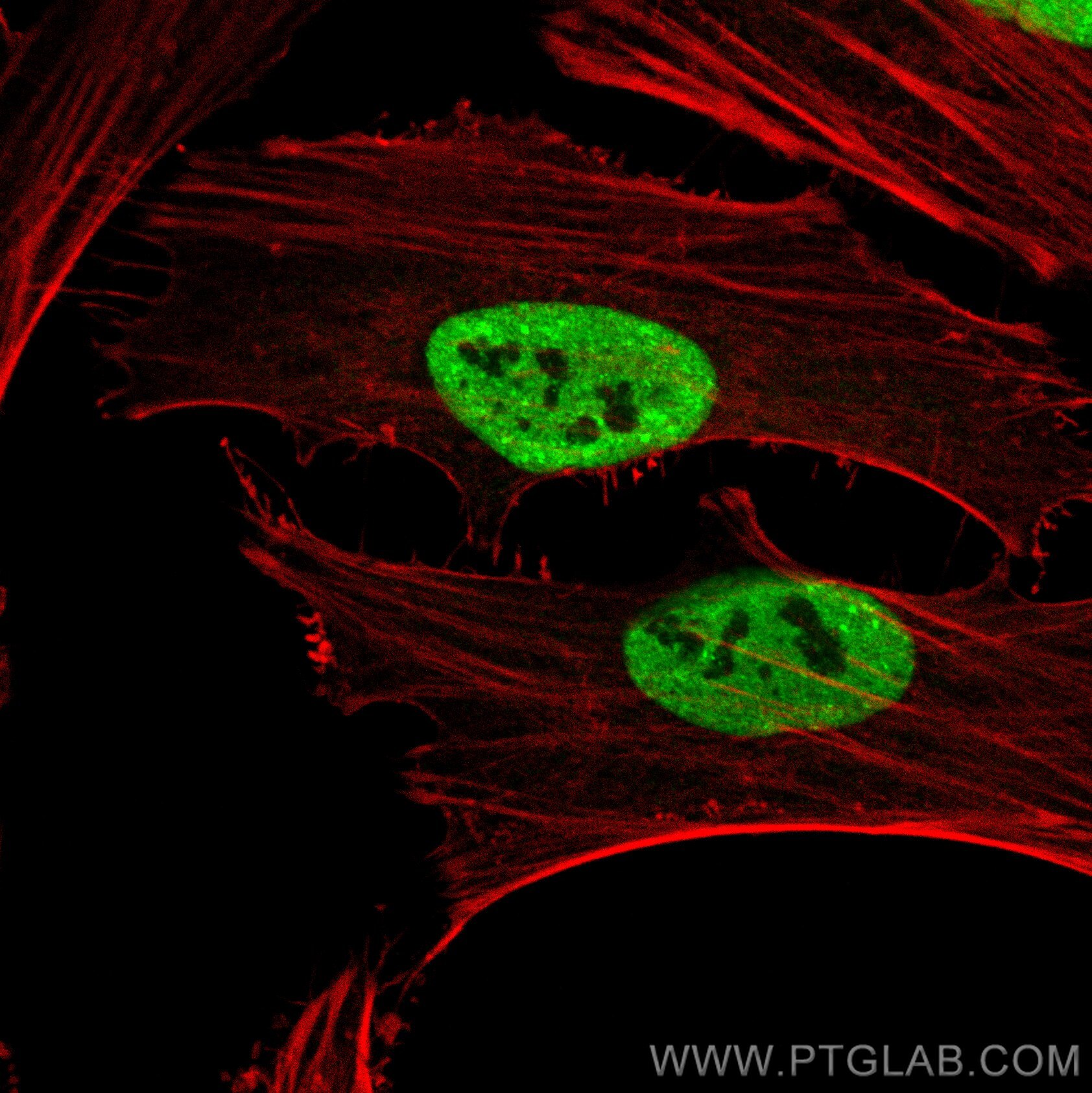 Immunofluorescence (IF) / fluorescent staining of HeLa cells using TDP-43 Recombinant antibody (80002-1-RR)