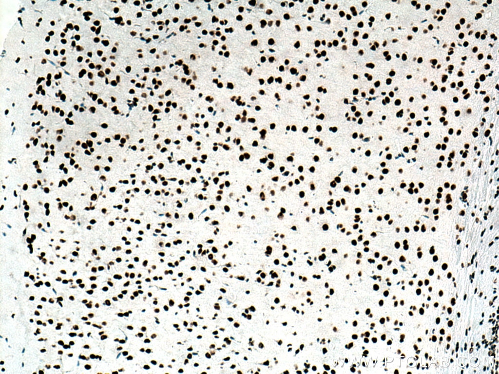IHC staining of mouse brain using 80002-1-RR