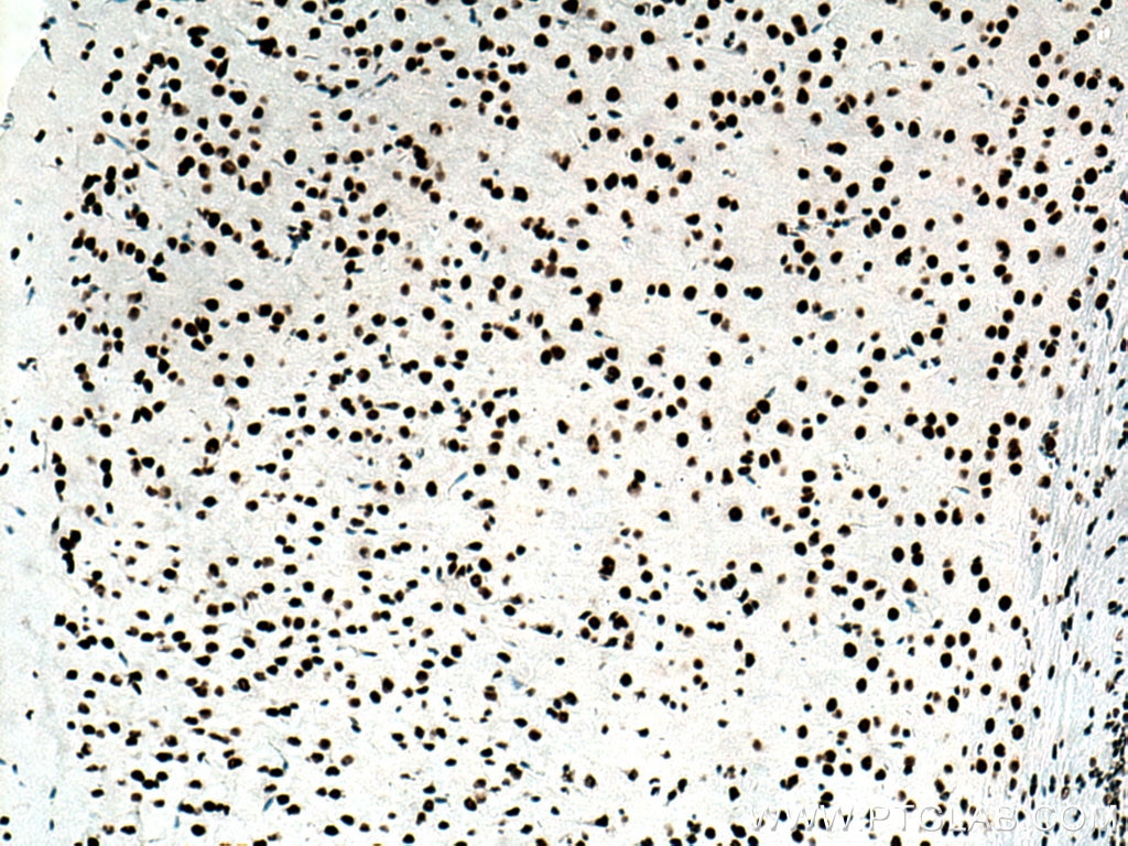 Immunohistochemistry (IHC) staining of mouse brain tissue using TDP-43 Recombinant antibody (80002-1-RR)