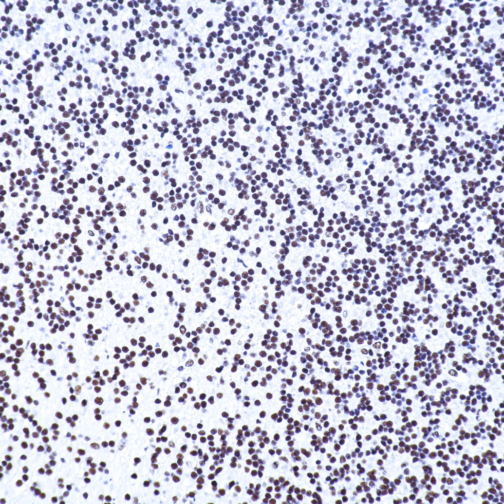 Immunohistochemistry (IHC) staining of human brain tissue using TDP-43 (N-terminal) Recombinant monoclonal antibod (80002-1-RR)