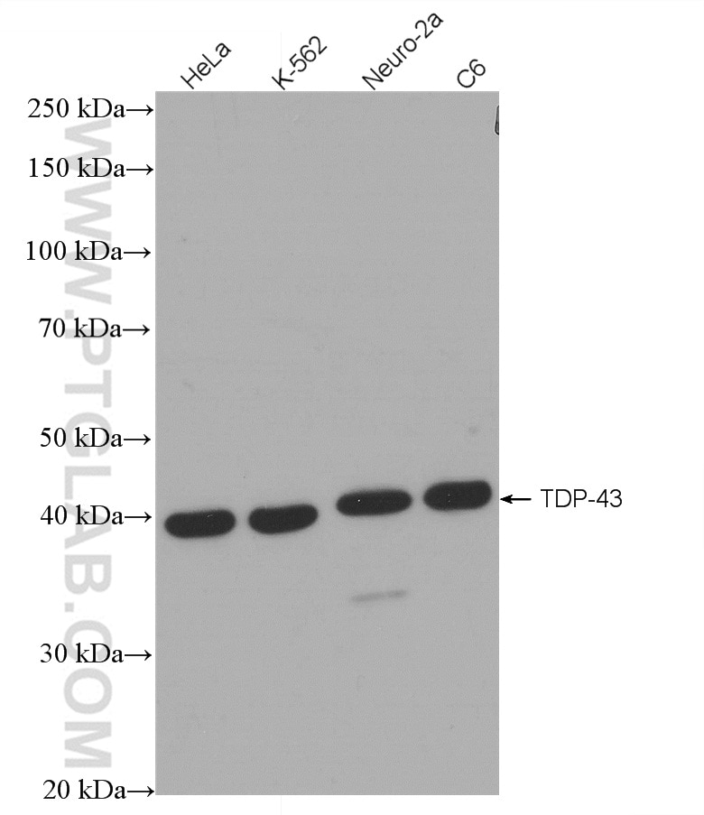 Western Blot (WB) analysis of various lysates using TDP-43 Recombinant antibody (80002-1-RR)