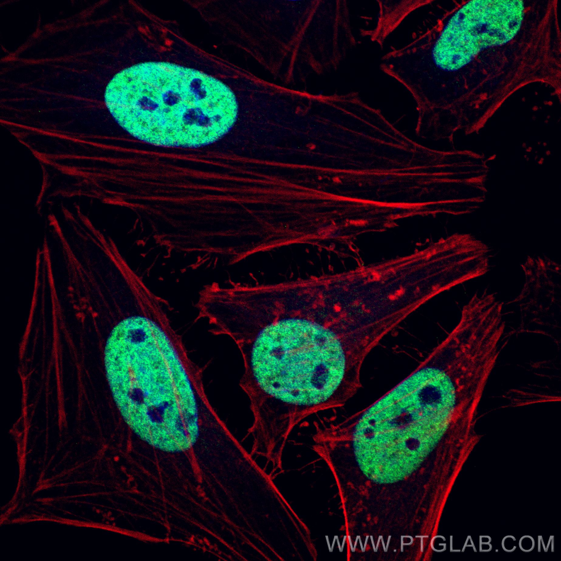 Immunofluorescence (IF) / fluorescent staining of HeLa cells using TDP-43 (C-terminal) Recombinant antibody (81350-1-RR)
