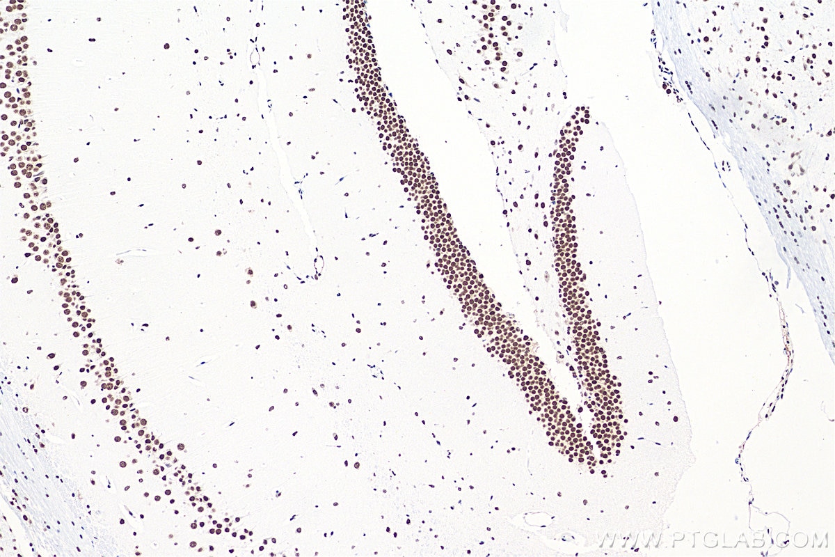 Immunohistochemistry (IHC) staining of mouse brain tissue using TDP-43 (C-terminal) Recombinant antibody (81350-1-RR)