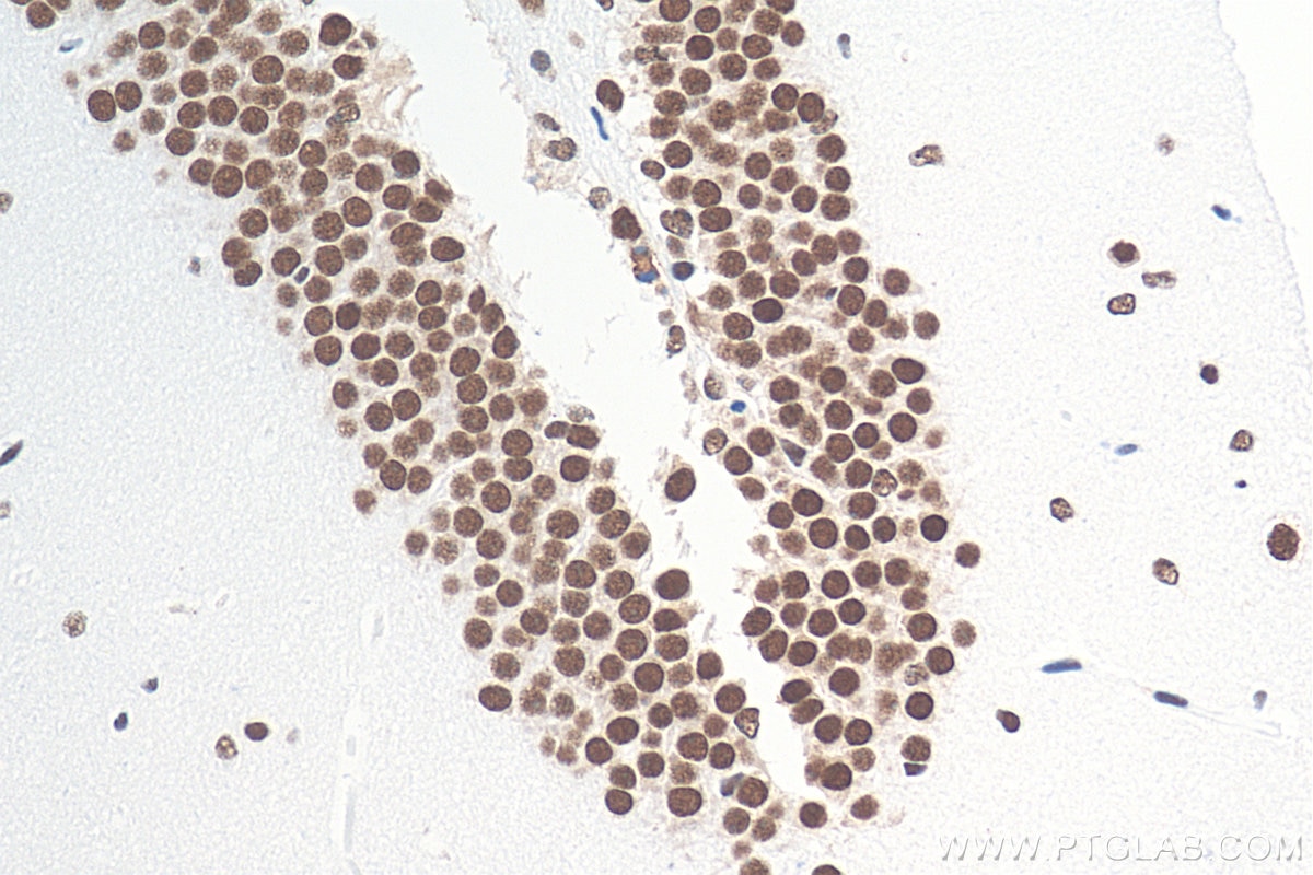 Immunohistochemistry (IHC) staining of mouse brain tissue using TDP-43 (C-terminal) Recombinant antibody (81350-1-RR)