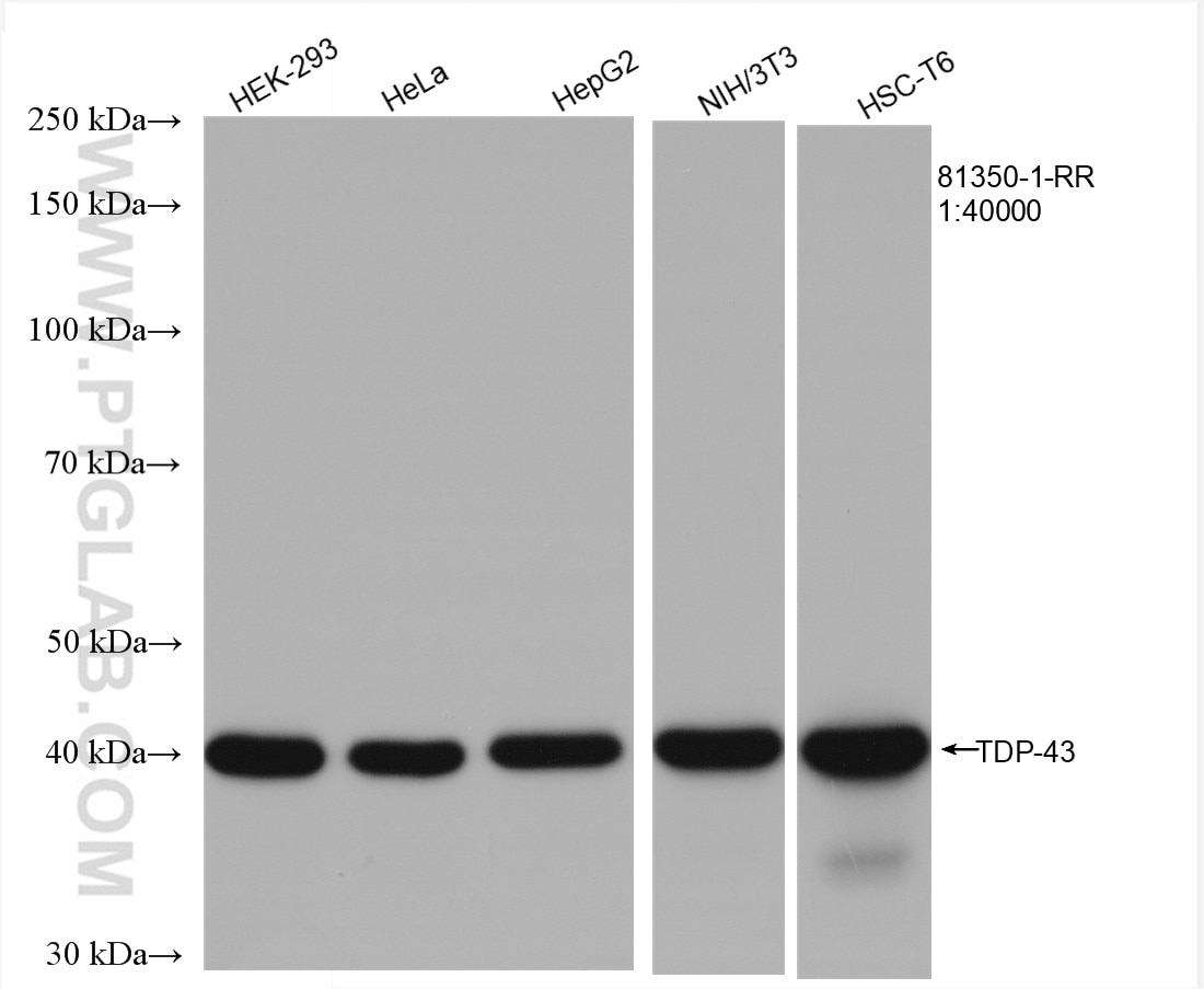 Western Blot (WB) analysis of various lysates using TDP-43 (C-terminal) Recombinant antibody (81350-1-RR)