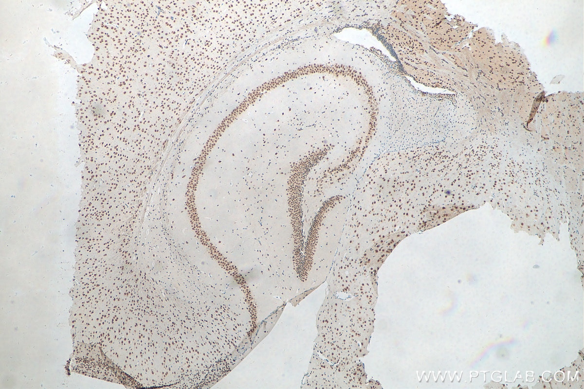 Immunohistochemistry (IHC) staining of mouse brain tissue using Biotin-conjugated TDP-43 Polyclonal antibody (Biotin-10782)