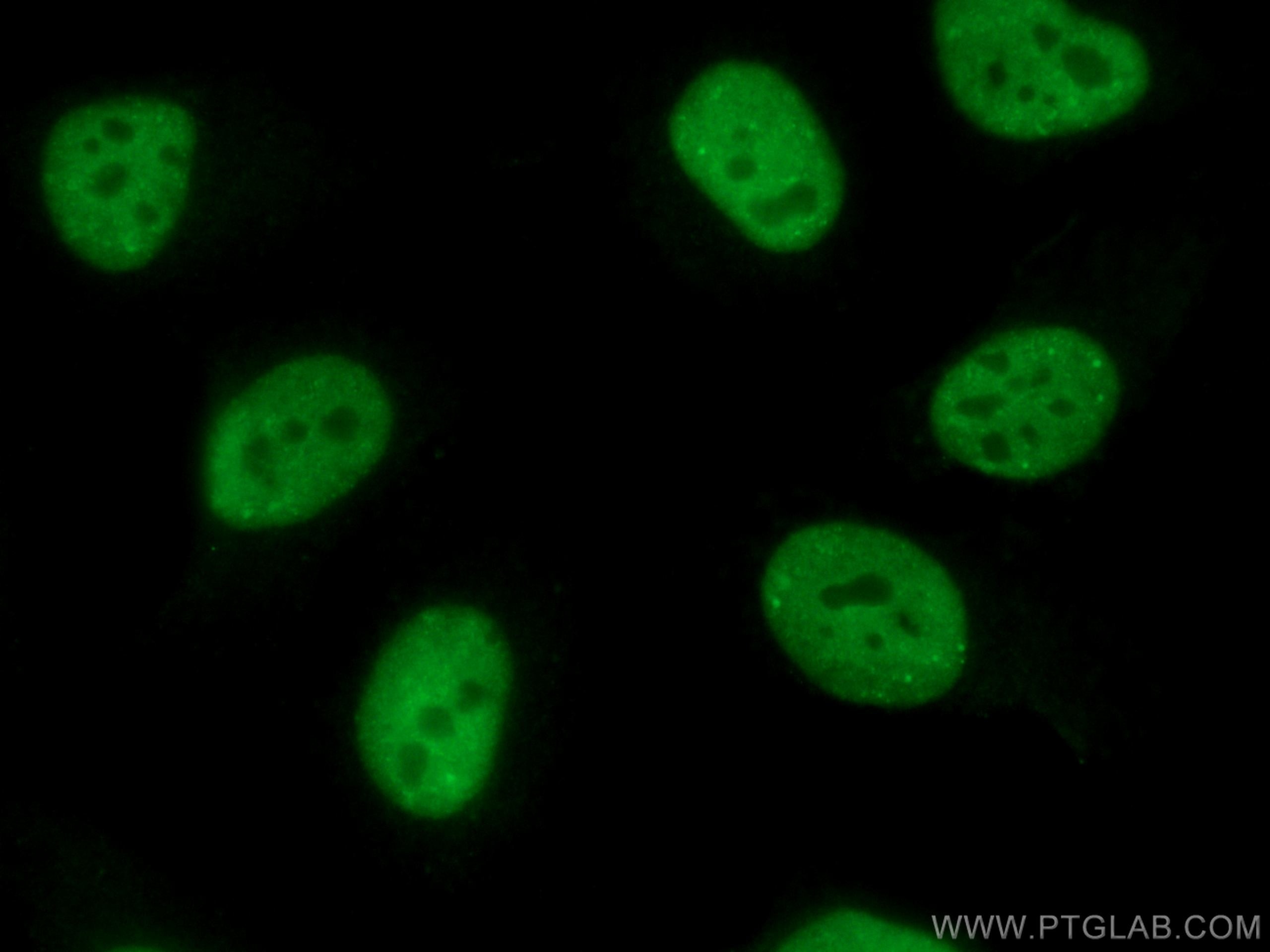 Immunofluorescence (IF) / fluorescent staining of HeLa cells using CoraLite® Plus 488-conjugated TDP-43 Polyclonal an (CL488-10782)