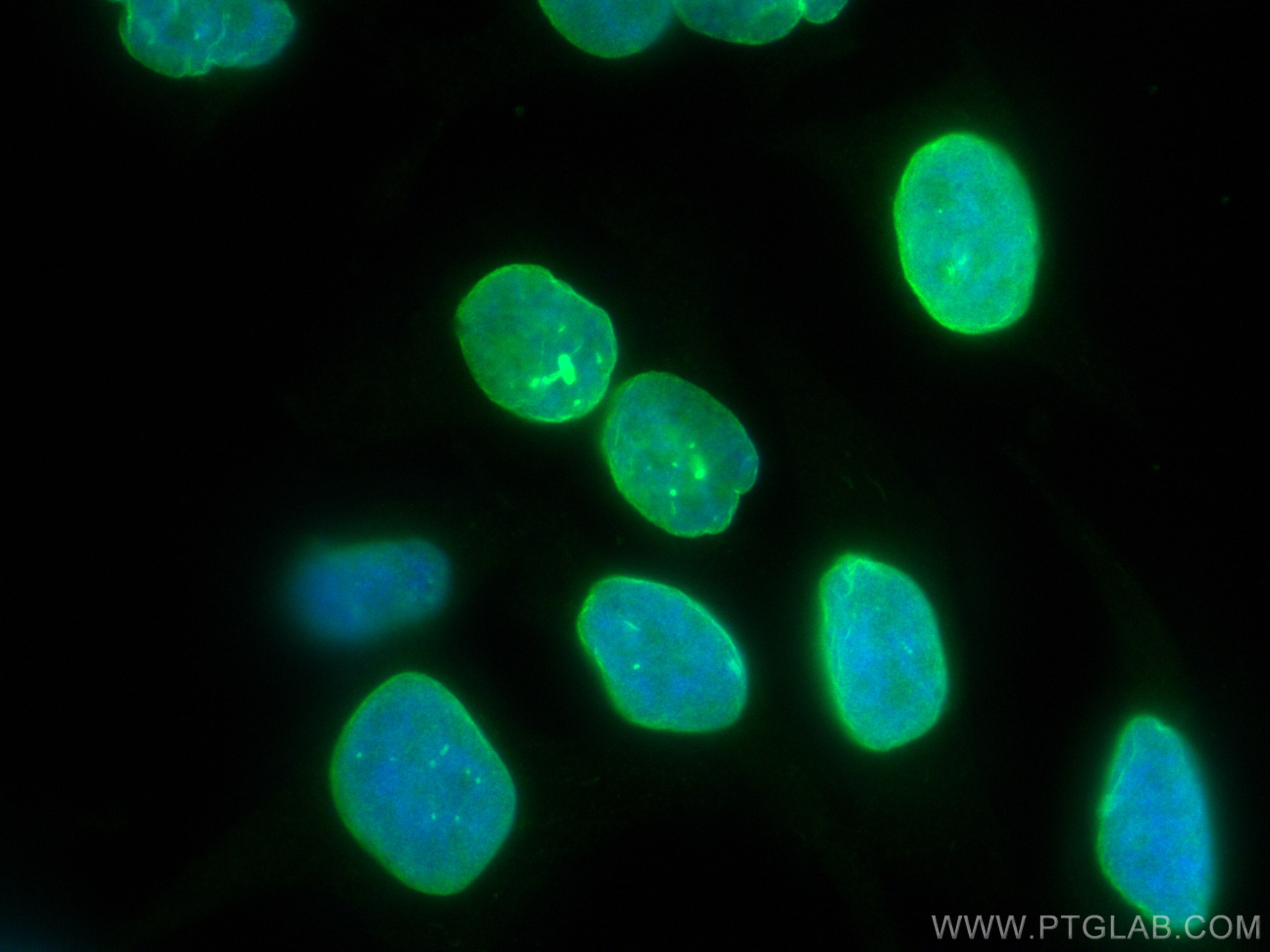 Immunofluorescence (IF) / fluorescent staining of HeLa cells using CoraLite® Plus 488-conjugated TDP-43 Recombinant a (CL488-80001)