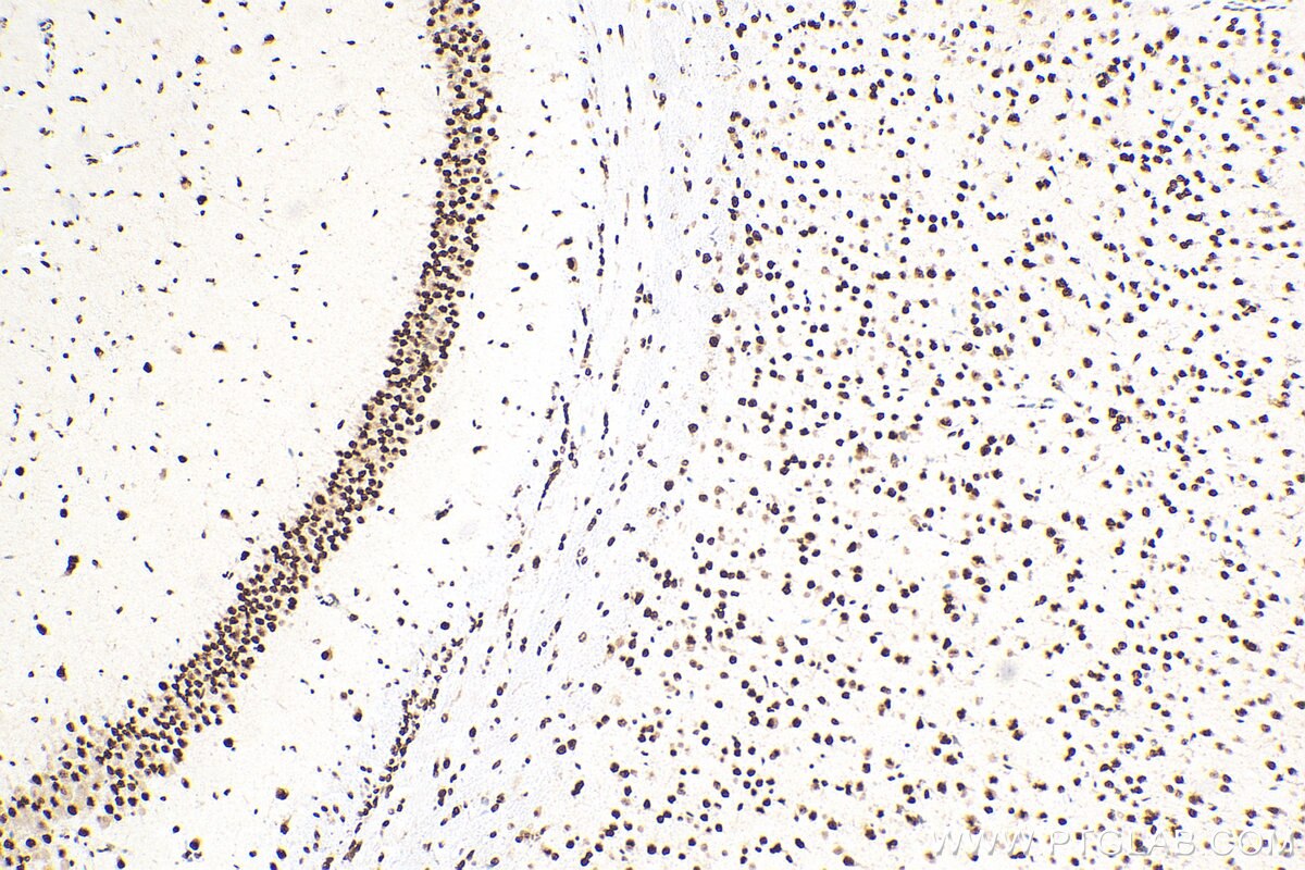 Immunohistochemistry (IHC) staining of mouse brain tissue using Biotin-conjugated TDP-43 (C-terminal) Polyclonal a (Biotin-12892)