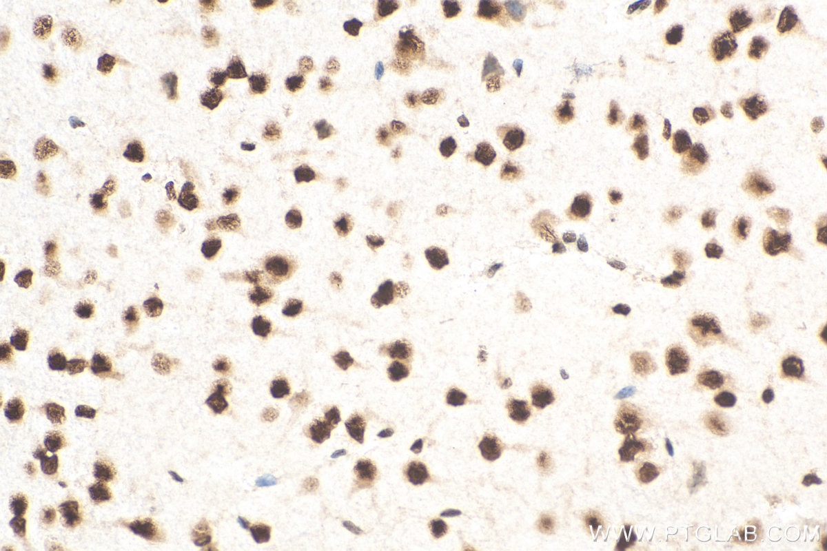 Immunohistochemistry (IHC) staining of mouse brain tissue using Biotin-conjugated TDP-43 (C-terminal) Polyclonal a (Biotin-12892)