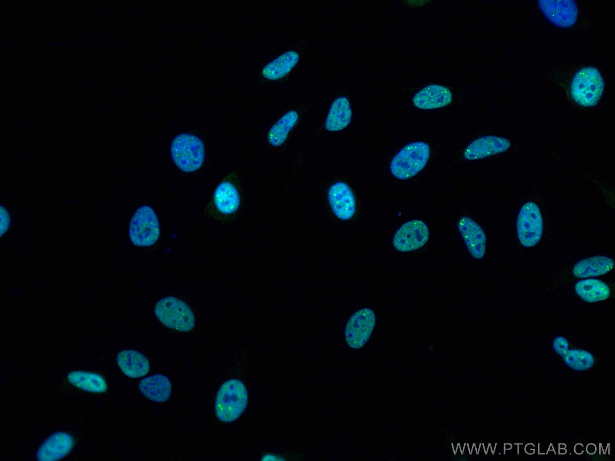 Immunofluorescence (IF) / fluorescent staining of HeLa cells using CoraLite® Plus 488-conjugated TDP-43 (C-terminal)  (CL488-12892)