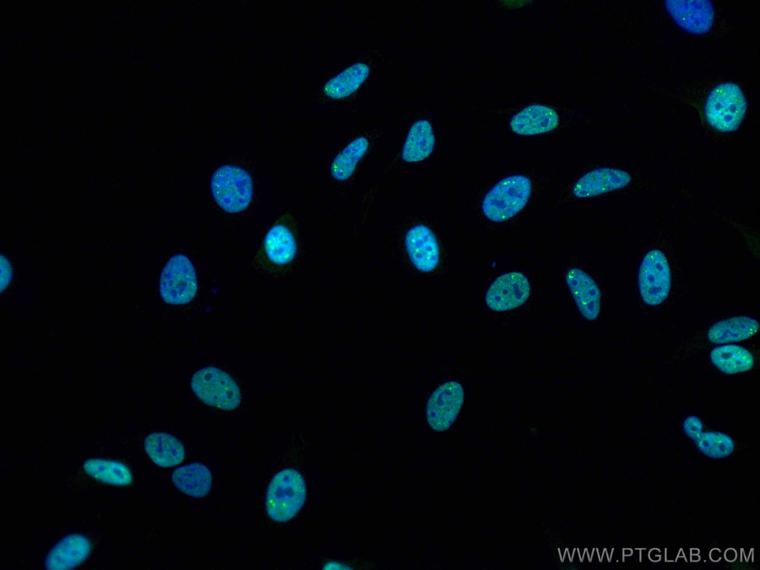 IF Staining of HeLa using CL488-12892