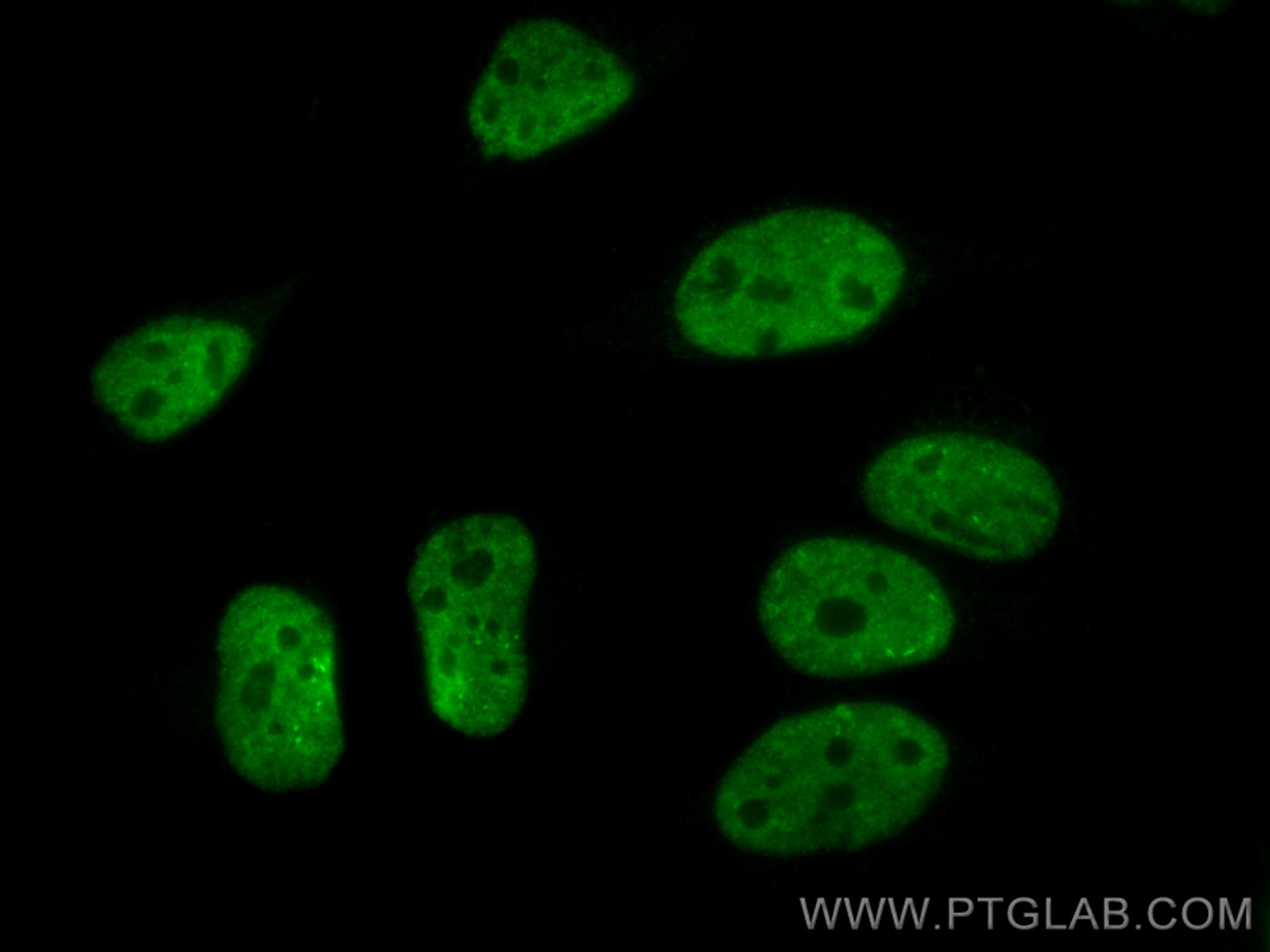 Immunofluorescence (IF) / fluorescent staining of HeLa cells using CoraLite® Plus 488-conjugated TDP-43 (C-terminal)  (CL488-12892)