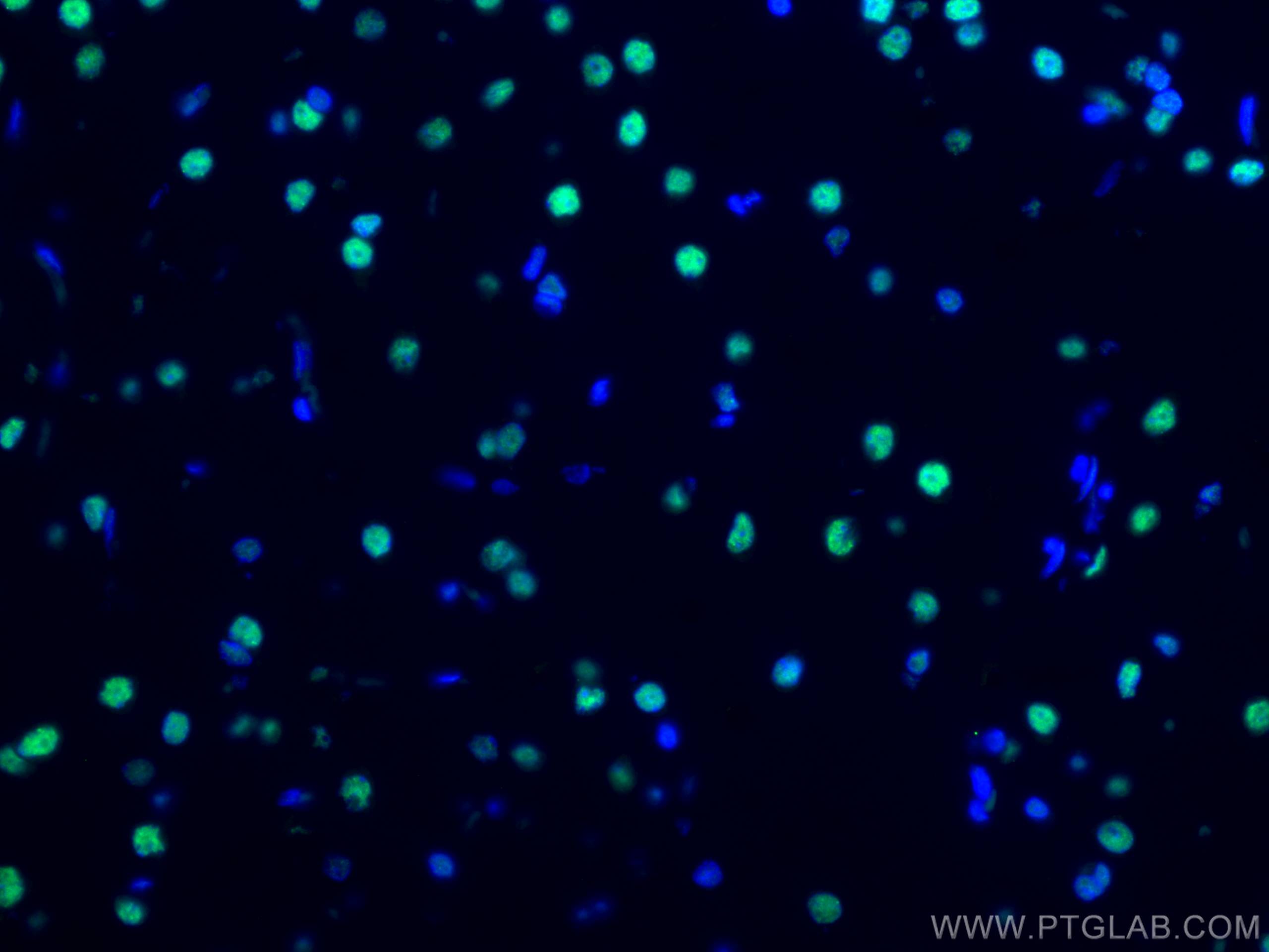 Immunofluorescence (IF) / fluorescent staining of rat brain tissue using CoraLite® Plus 488-conjugated TDP-43 (C-terminal)  (CL488-67345)