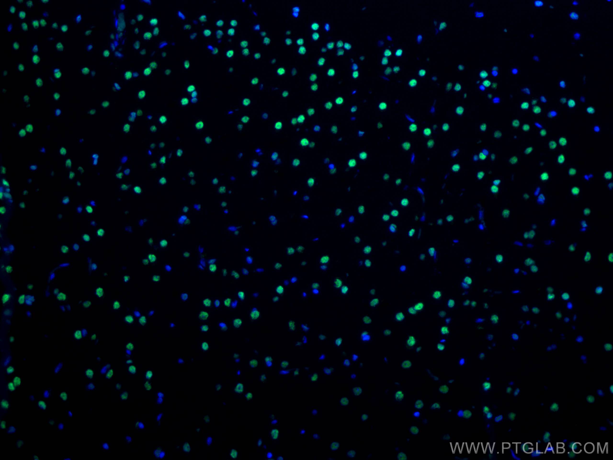 Immunofluorescence (IF) / fluorescent staining of rat brain tissue using CoraLite® Plus 488-conjugated TDP-43 (C-terminal)  (CL488-67345)