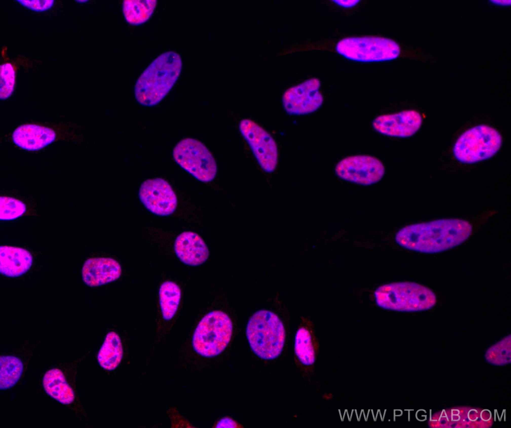 Immunofluorescence (IF) / fluorescent staining of HeLa cells using CoraLite®594-conjugated TDP-43 (C-terminal) Polycl (CL594-12892)