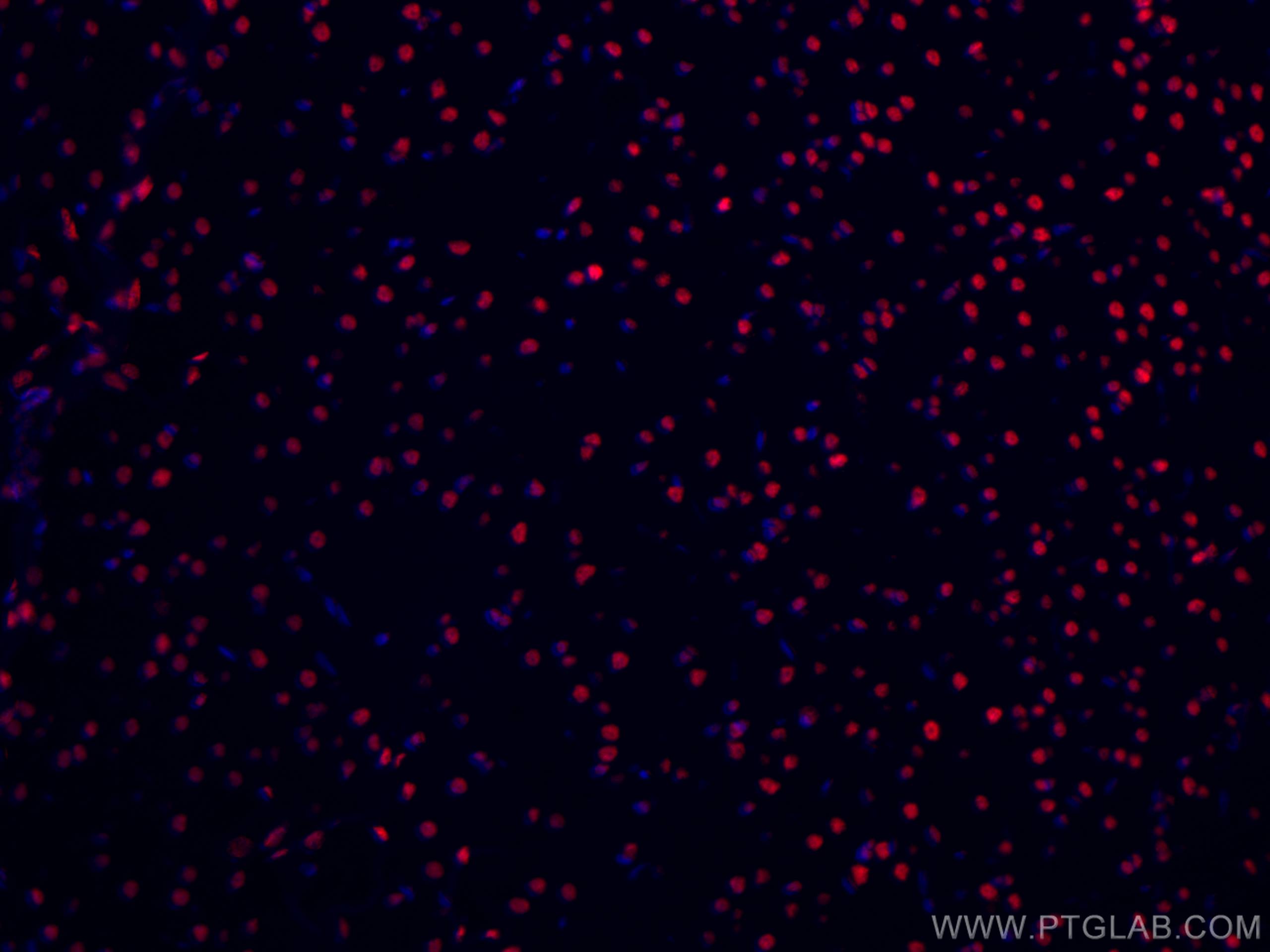 Immunofluorescence (IF) / fluorescent staining of rat brain tissue using CoraLite®594-conjugated TDP-43 (C-terminal) Monocl (CL594-67345)
