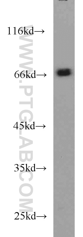 Western Blot (WB) analysis of HeLa cells using TDP1 Polyclonal antibody (10641-1-AP)