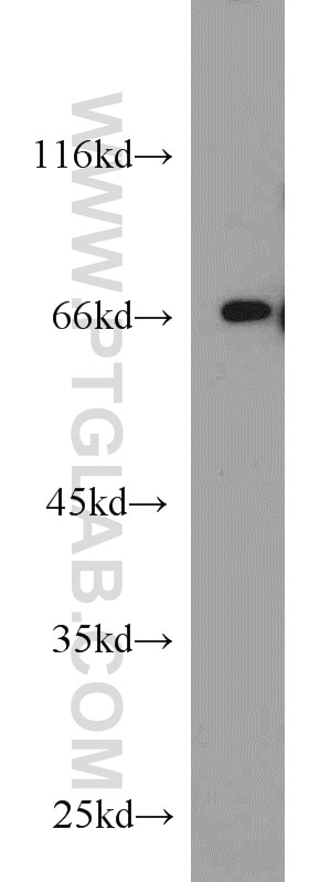 Western Blot (WB) analysis of MCF-7 cells using TDP1 Polyclonal antibody (10641-1-AP)