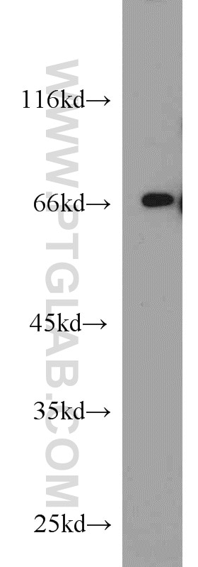 WB analysis of MCF-7 using 10641-1-AP