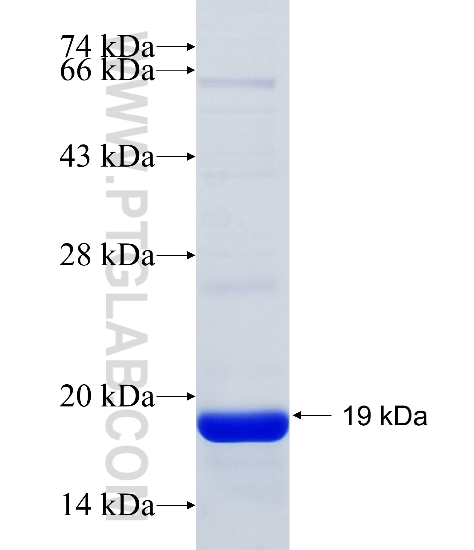 TDRD1 fusion protein Ag34247 SDS-PAGE TDRD1 fusion protein Ag34247 SDS-PAGE