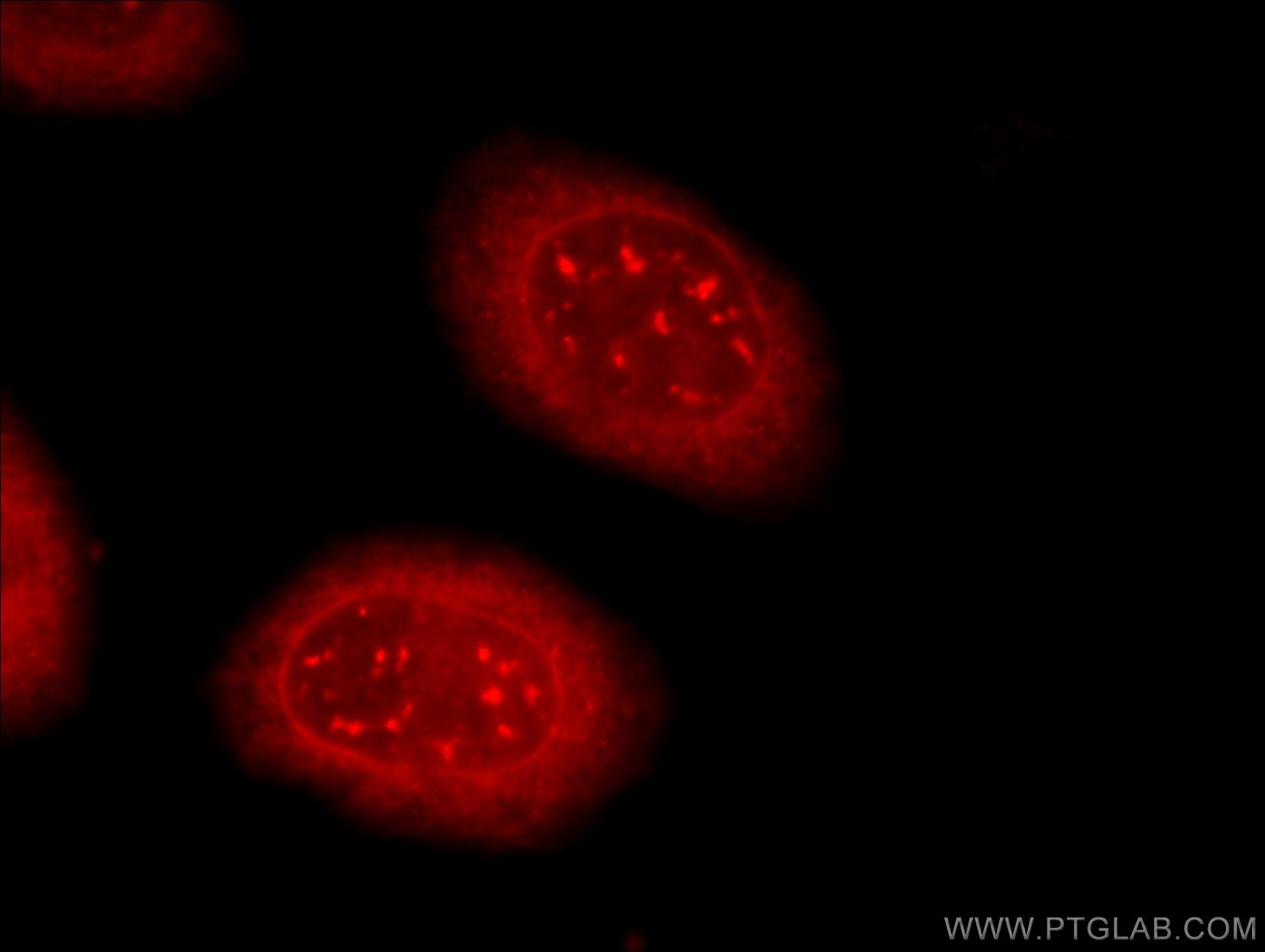 Immunofluorescence (IF) / fluorescent staining of HeLa cells using TDRD3 Polyclonal antibody (13359-1-AP)