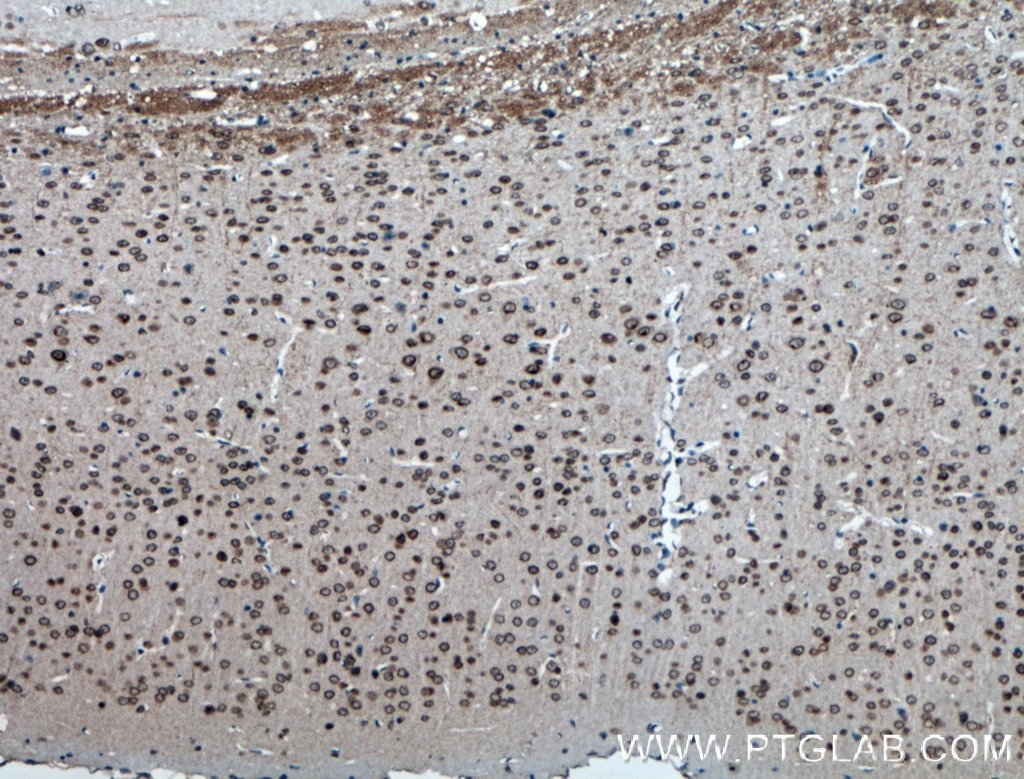 Immunohistochemistry (IHC) staining of mouse brain tissue using TDRD3 Polyclonal antibody (13359-1-AP)