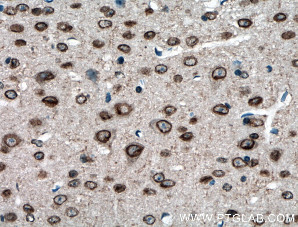 Immunohistochemistry (IHC) staining of mouse brain tissue using TDRD3 Polyclonal antibody (13359-1-AP)