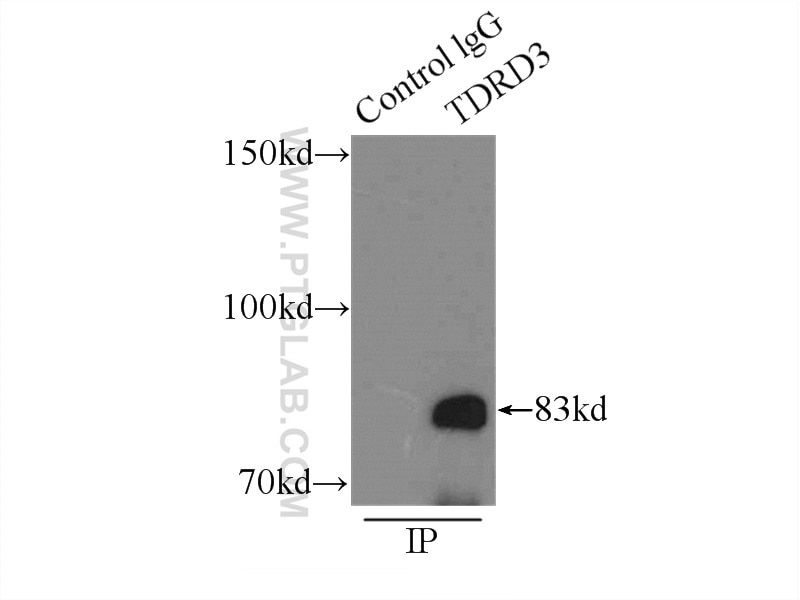 Immunoprecipitation (IP) experiment of HeLa cells using TDRD3 Polyclonal antibody (13359-1-AP)