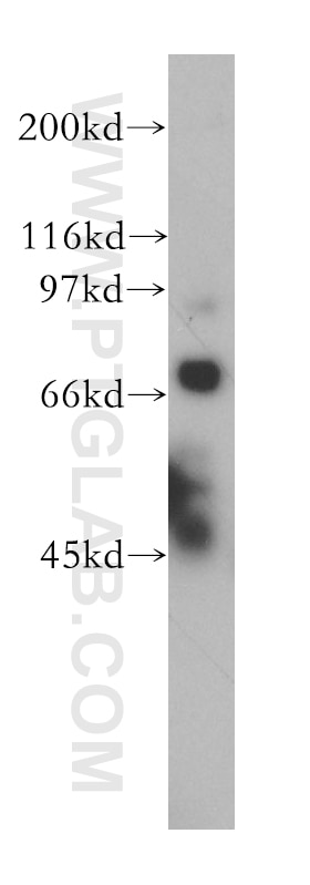Western Blot (WB) analysis of HEK-293 cells using TDRD3 Polyclonal antibody (13359-1-AP)
